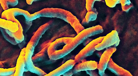 Ebola-Virus unter dem Elektronenmikroskop