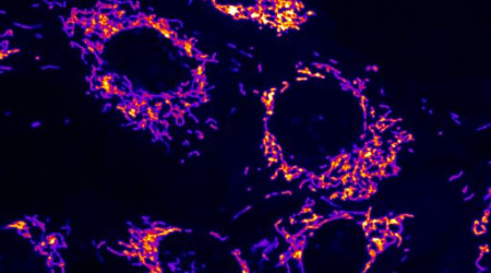 Fluoreszenzmikroskopische Aufnahme von Mitochondrien, die mit einem Farbstoff angefärbt wurden. Bild: Nicola Roverato, Universität Konstanz